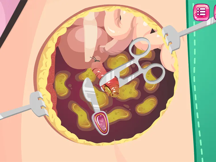 Beauty Ella Appendix Surgery game thumbnail